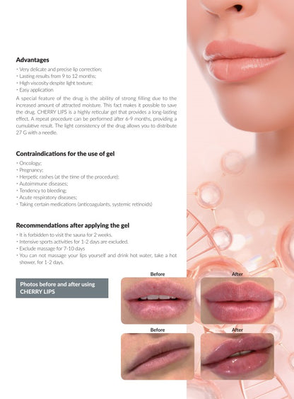 MEDIPLUS CHERRY LIPS